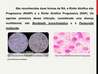 São reconhecidas duas formas de RA, a Rinite Atrófica não
Progressiva (RANP) e a Rinite Atrófica Progressiva (RAP). Os
agentes primários dessa infecção, considerada uma doença
multifatorial, são Bordetella bronchiseptica e a Pasteurella
multocida.
Fig 1. Coloração de Gram de Bordetella bronchiseptica em dois Fig 2. Pasteurella multocida cultivada em ágar sangue.
graus diferentes de ampliação.
 