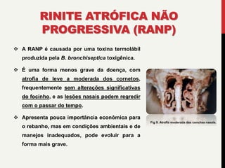 RINITE ATRÓFICA NÃO
PROGRESSIVA (RANP)
 A RANP é causada por uma toxina termolábil
produzida pela B. bronchiseptica toxigênica.
 É uma forma menos grave da doença, com
atrofia de leve a moderada dos cornetos,
frequentemente sem alterações significativas
do focinho, e as lesões nasais podem regredir
com o passar do tempo.
 Apresenta pouca importância econômica para
o rebanho, mas em condições ambientais e de
manejos inadequados, pode evoluir para a
forma mais grave.
Fig 9. Atrofia moderada das conchas nasais.
 