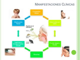 MANIFESTACIONES CLÍNICAS
Congestión
Nasal
Estornudos en
serie
Prurito Nasal y
Ocular
Rinorrea
Lagrimeo y
Enrojecimiento
Ocular
Obstrucción
Nasal
 