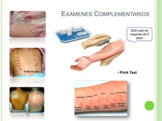 • Prick Test
Sólo usar en
mayores de 5
años
EXÁMENES COMPLEMENTARIOS
 
