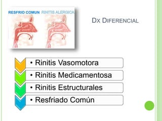 DX DIFERENCIAL
• Rinitis Vasomotora
• Rinitis Medicamentosa
• Rinitis Estructurales
• Resfriado Común
 