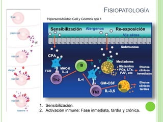 FISIOPATOLOGÍA
Hipersensibilidad Gell y Coombs tipo 1
1. Sensibilización.
2. Activación inmune: Fase inmediata, tardía y crónica.
 