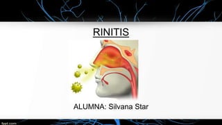 RINITIS
ALUMNA: Silvana Star
 