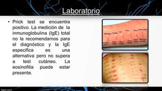 Laboratorio
• Prick test se encuentra
positivo. La medición de la
inmunoglobulina (IgE) total
no la recomendamos para
el diagnóstico y la IgE
especifica es una
alternativa pero no supera
a test cutáneo. La
eosinofilia puede estar
presente.
 