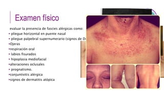 Examen físico
evaluar la presencia de fascies alérgicas como:
 pliegue horizontal en puente nasal
 pliegue palpebral supernumerario (signos de DennieMorgan),
Ojeras
respiración oral
 labios fisurados
 hipoplasia mediofacial
alteraciones oclusales
 prognatismo.
conjuntivitis alérgica
signos de dermatitis atópica
 