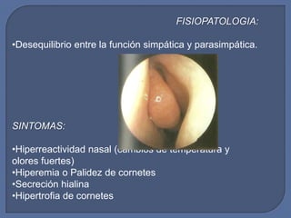 FISIOPATOLOGIA:

•Desequilibrio entre la función simpática y parasimpática.




SINTOMAS:

•Hiperreactividad nasal (cambios de temperatura y
olores fuertes)
•Hiperemia o Palidez de cornetes
•Secreción hialina
•Hipertrofia de cornetes
 