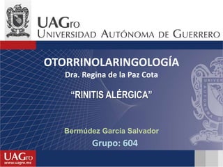 Bermúdez García Salvador
Grupo: 604
“RINITIS ALÉRGICA”
OTORRINOLARINGOLOGÍA
Dra. Regina de la Paz Cota
 
