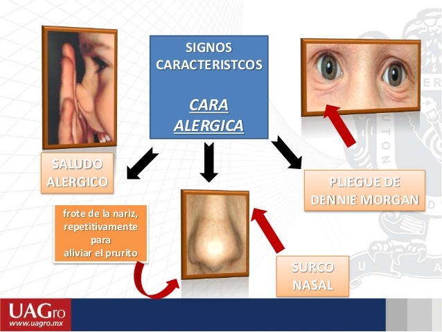 La psoriasis de las uñas de los dedos de las manos el tratamiento medicamentoso