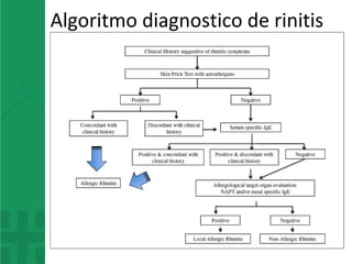 Algoritmo diagnostico de rinitis
 
