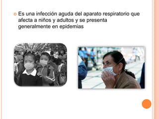  Es una infección aguda del aparato respiratorio que
afecta a niños y adultos y se presenta
generalmente en epidemias
 