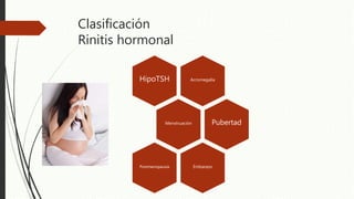 Clasificación
Rinitis hormonal
AcromegaliaHipoTSH
Menstruación Pubertad
EmbarazoPostmenopausia
 