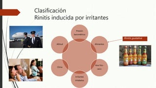 Clasificación
Rinitis inducida por irritantes
Presión
barométrica
Alimentos
Aire frio-
seco
Irritantes
inhalados
Clima
Altitud
Rinitis gustativa
 