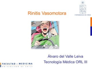 Rinitis Vasomotora Álvaro del Valle Leiva Tecnología Médica ORL III http://www.idearsalud.com.ar   (28/03/2010, 15:35)  