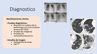 Diagnostico
Manifestaciones clínicas
- Pruebas diagnósticas
● Reacción en cadena de la
polimerasa con transcriptasa
inversa (RT-PCR)
● Prueba de antígenos
● Pruebas de
inmunofluorescencia.
- Estudios de imagen
● Radiografia de torax
● TAC**
 