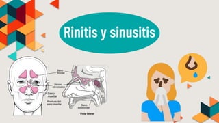 Rinitis y sinusitis
 