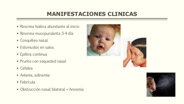 Rinitis Y Sinusitis Qu Son Y Cmo Se Solucionan