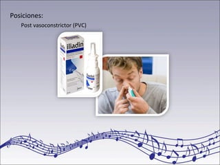 Posiciones:
Post vasoconstrictor (PVC)
 