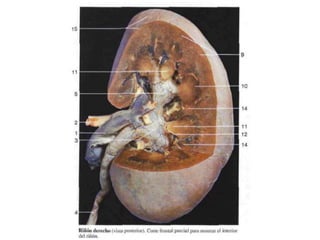 Riñones y ureteres