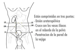 Riñones y ureteres