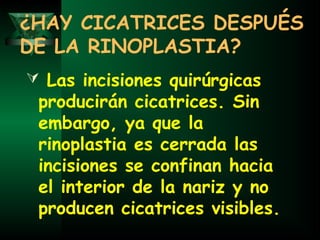 ¿HAY CICATRICES DESPUÉS
DE LA RINOPLASTIA?
 Las incisiones quirúrgicas
 producirán cicatrices. Sin
 embargo, ya que la
 rinoplastia es cerrada las
 incisiones se confinan hacia
 el interior de la nariz y no
 producen cicatrices visibles.
 
