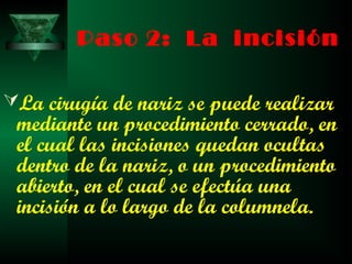 Paso 2: La incisión

La cirugía de nariz se puede realizar
 mediante un procedimiento cerrado, en
 el cual las incisiones quedan ocultas
 dentro de la nariz, o un procedimiento
 abierto, en el cual se efectúa una
 incisión a lo largo de la columnela.
 
