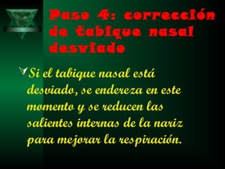 Paso 4: corrección
     de tabique nasal
     desviado
Si el tabique nasal está
 desviado, se endereza en este
 momento y se reducen las
 salientes internas de la nariz
 para mejorar la respiración.
 
