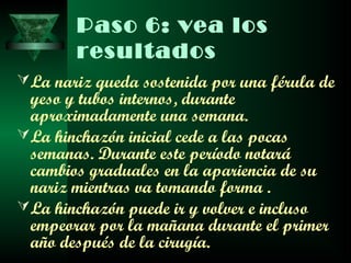 Paso 6: vea los
        resultados
 La nariz queda sostenida por una férula de
  yeso y tubos internos, durante
  aproximadamente una semana.
 La hinchazón inicial cede a las pocas
  semanas. Durante este período notará
  cambios graduales en la apariencia de su
  nariz mientras va tomando forma .
 La hinchazón puede ir y volver e incluso
  empeorar por la mañana durante el primer
  año después de la cirugía.
 