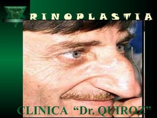 R I N O P L A S T I A
 