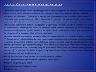 COLOCACIÓN DE UN INJERTO EN LA COLUMELA
La colocación de este tipo de injertos mejora el soporte de la punta nasal y puede dar un aspecto más satisfactorio a la
proyección de la misma. También puede usarse para corregir una anomalía de los pilares mediales. Puede ser
colocado por abordaje externo o interno. En el abordaje externo es necesario crear un bolsillo entre los pilares. El
injerto ha de medir normalmente entre 8-12 mm de largo, por 3-4 de ancho y 1-2 de grosor. Puede ser extraído del
propio septo o bien de otras zonas donantes de cartílago, como la concha auricular o las costillas. Al colocarlo es
preferible dejar un remanente de tejidos blandos entre la espina nasal y el injerto. No debería extenderse por encima
del pilar intermedio. En la rinoplastia cerrada, se realiza una incisión vestibular y transcrural. Se introduce el injerto y
se manipula hasta alojarlo en la posición deseada. Se utilizan suturas transfixiantes para fijarlo. Una alternativa para
dar más proyección a la punta es utilizar un injerto en paraguas.
Se trata de una técnica habitual en el tratamiento de la punta nasal mediante la colocación de un injerto en forma de
“T”. Algunos autores realizan el tallado del injerto con concha auricular para constituir el vástago y cartílago nasal para
el sombrero. El injerto ha de colocarse en un bolsillo entre los pilares mediales. La porción más alta del mismo ha de
recortarse en ocasiones, para darle forma al ángulo nasal anterior. Si se dejase como único constituyente de la punta,
crearía una impronta en la piel, con forma puntiaguda, que a la larga podría causar una úlcera de presión, por ello es
necesario colocar en su porción más alta un injerto “onlay”, perpendicular al mismo, para darle el aspecto de paraguas.
Las indicaciones para este tipo de injertos son:
•Pérdida de proyección de la punta nasal tras una realización una rinoplastia.
•Pérdida de proyección de la punta después de perder el soporte septal.
•Punta con piel gruesa, punta amorfa.
•Acortamiento congénito de la punta nasal.
•Punta nasal caída.
 