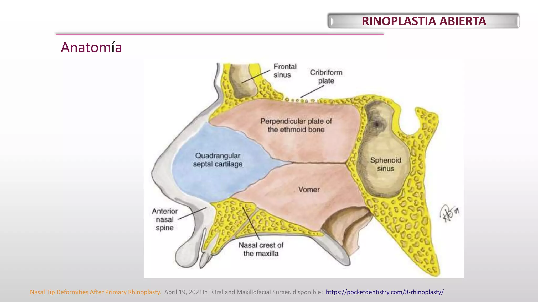 Rinoplastia abierta. por Hanmer Roa . 2021 | PPTX | Ear, Nose and ...
