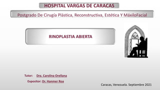 Tutor: Dra. Carolina Orellana
Expositor: Dr. Hanmer Roa
HOSPITAL VARGAS DE CARACAS
Postgrado De Cirugía Plástica, Reconstructiva, Estética Y MáxiloFacial
RINOPLASTIA ABIERTA
Caracas, Venezuela. Septiembre 2021
 