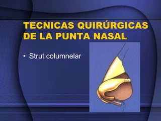 TECNICAS QUIRÚRGICAS
DE LA PUNTA NASAL
• Strut columnelar
 