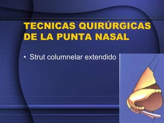 TECNICAS QUIRÚRGICAS
DE LA PUNTA NASAL
• Strut columnelar extendido
 