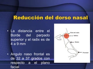 Reducción del dorso nasal
• La distancia entre el
Borde del parpado
superior y el radix es de
4 a 9 mm
• Angulo naso frontal es
de 32 a 37 grados con
respecto a el plano
facial
 