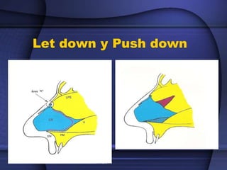 Let down y Push down
 