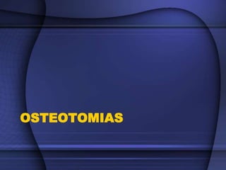 OSTEOTOMIAS
 
