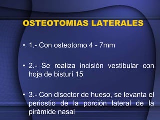 OSTEOTOMIAS LATERALES
• 1.- Con osteotomo 4 - 7mm
• 2.- Se realiza incisión vestibular con
hoja de bisturí 15
• 3.- Con disector de hueso, se levanta el
periostio de la porción lateral de la
pirámide nasal
 