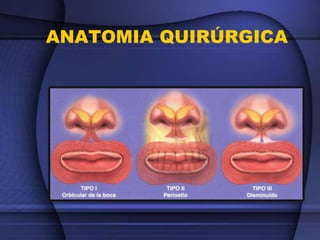 ANATOMIA QUIRÚRGICA
 