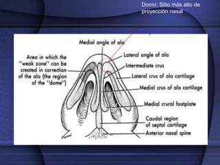 Domo: Sitio más alto de
proyección nasal
 