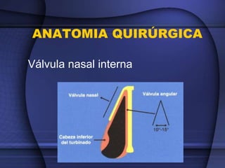 ANATOMIA QUIRÚRGICA
Válvula nasal interna
 