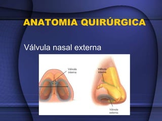 ANATOMIA QUIRÚRGICA
Válvula nasal externa
 