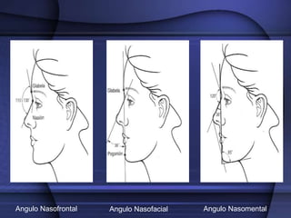 Angulo Nasofrontal Angulo Nasofacial Angulo Nasomental
 