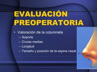 EVALUACIÓN
PREOPERATORIA
• Valoración de la columnela
– Soporte
– Cruras medias
– Longitud
– Tamaño y posición de la espina nasal
 