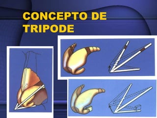 CONCEPTO DE
TRIPODE
 