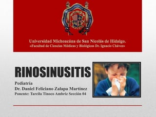 RINOSINUSITIS
Pediatría
Dr. Daniel Feliciano Zalapa Martínez
Ponente: Tarcila Tinoco Ambriz Sección 04
 