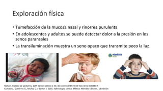 Exploración física
• Tumefacción de la mucosa nasal y rinorrea purulenta
• En adolescentes y adultos se puede detectar dolor a la presión en los
senos paransales
• La transiluminación muestra un seno opaco que transmite poco la luz
Nelson. Tratado de pediatría, 20th Edition (2016) 1-50. doi:10.1016/B978-84-9113-015-4.00380-4
Kumate J., Gutiérrez G., Muñoz O. y Santos J. 2016. Infectología clínica. México: Méndez Editores. 18 edición
 