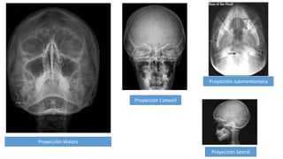 Proyección Waters
Proyección Cadwell
Proyección submentoniana
Proyección lateral
 