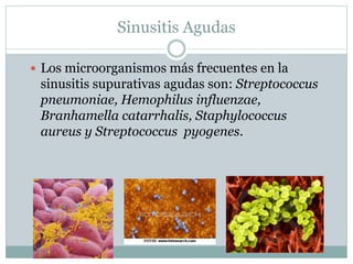 Sinusitis Agudas
 Los microorganismos más frecuentes en la
sinusitis supurativas agudas son: Streptococcus
pneumoniae, Hemophilus influenzae,
Branhamella catarrhalis, Staphylococcus
aureus y Streptococcus pyogenes.
 
