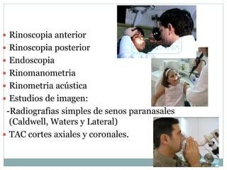  Rinoscopia anterior
 Rinoscopia posterior
 Endoscopia
 Rinomanometria
 Rinometria acústica
 Estudios de imagen:
-Radiografias simples de senos paranasales
(Caldwell, Waters y Lateral)
 TAC cortes axiales y coronales.
 