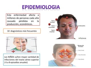 Esta enfermedad afecta a
millones de personas cada año
causado pérdidas en la
producción, económicos.
10 diagnósticos más frecuentes
Los NIÑOS sufren mayor cantidad de
infecciones del tracto aéreo superior
( 6 a 8 episodios anuales)
ADULTO
1
2
3
4
 